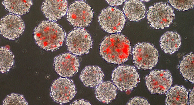 Bid to Block Human Embryonic Stem Cell Research Fails!